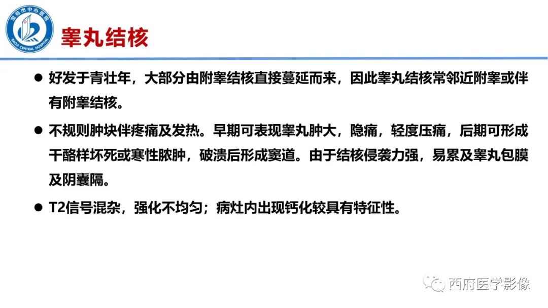 影像PPT - 【PPT】睾丸肿瘤及肿瘤样病变影像诊断与鉴别-38