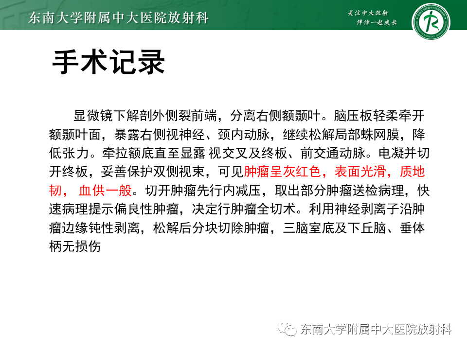 影像PPT - 【PPT】垂体细胞瘤-4