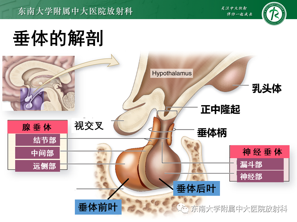 影像PPT - 【PPT】垂体细胞瘤-8
