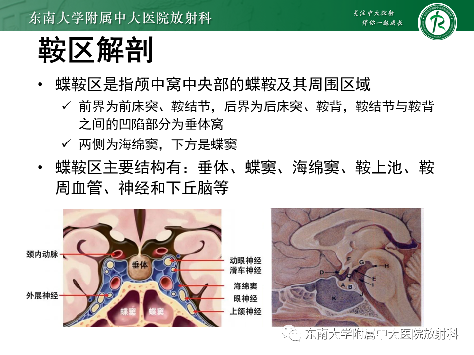影像PPT - 【PPT】垂体细胞瘤-7