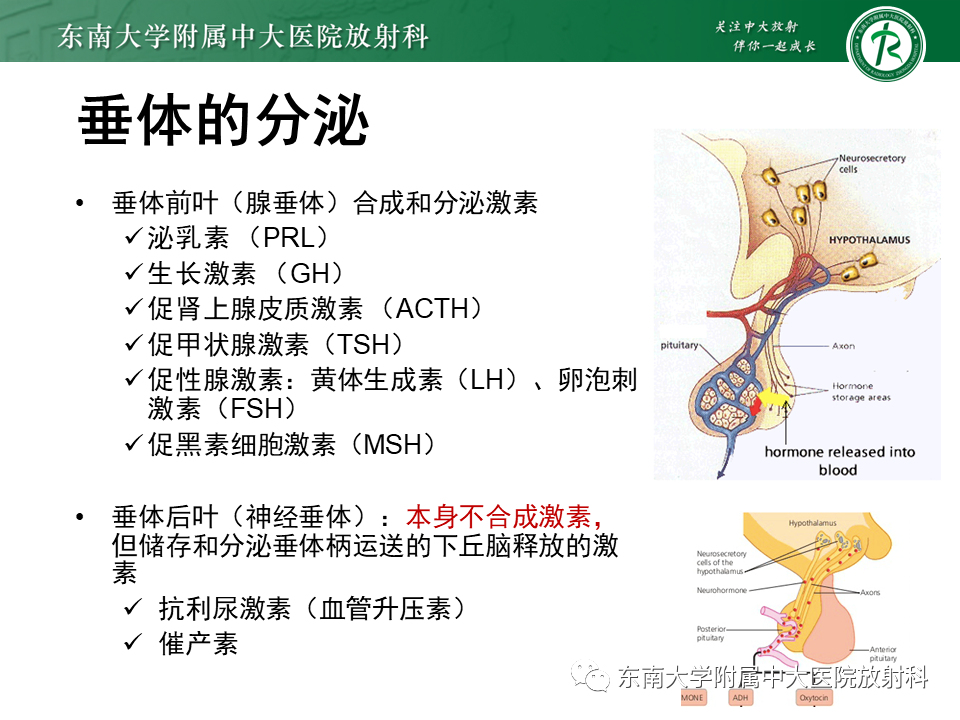 影像PPT - 【PPT】垂体细胞瘤-12