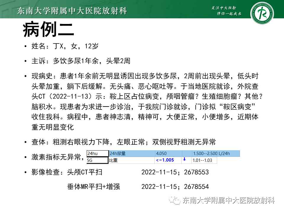影像PPT - 【PPT】垂体细胞瘤-21