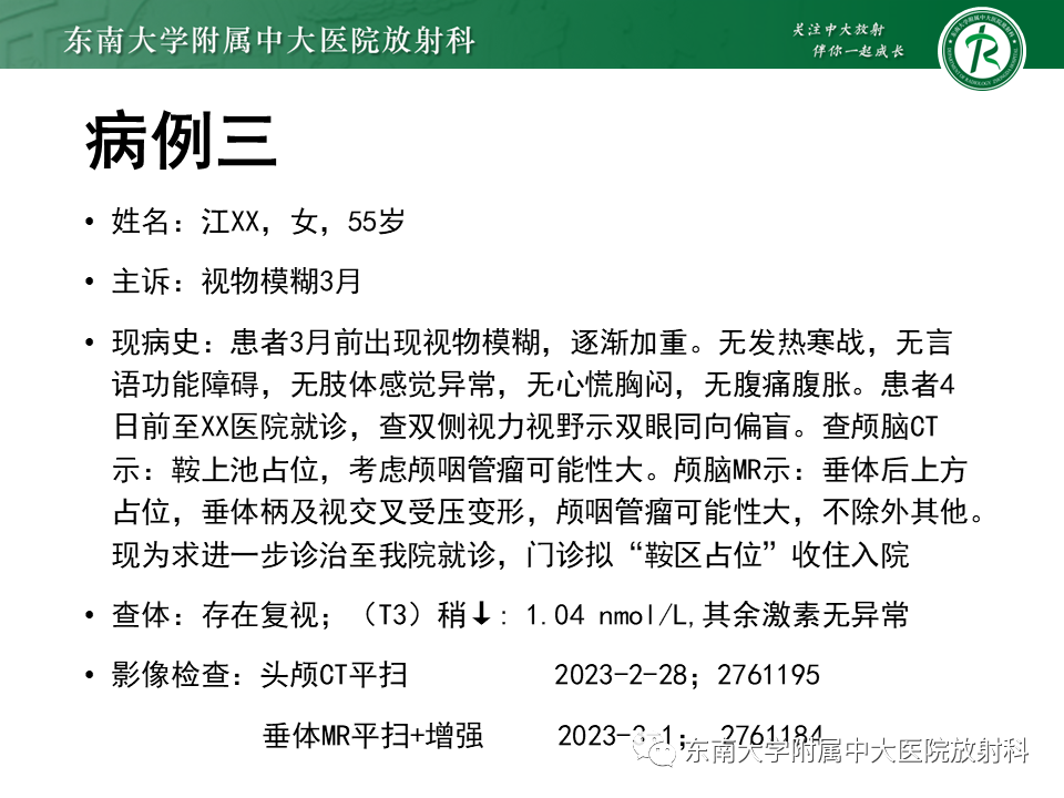 影像PPT - 【PPT】垂体细胞瘤-27