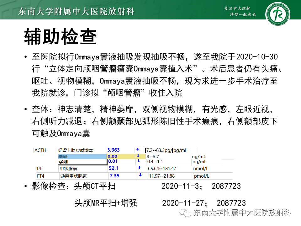 影像PPT - 【PPT】垂体细胞瘤-38