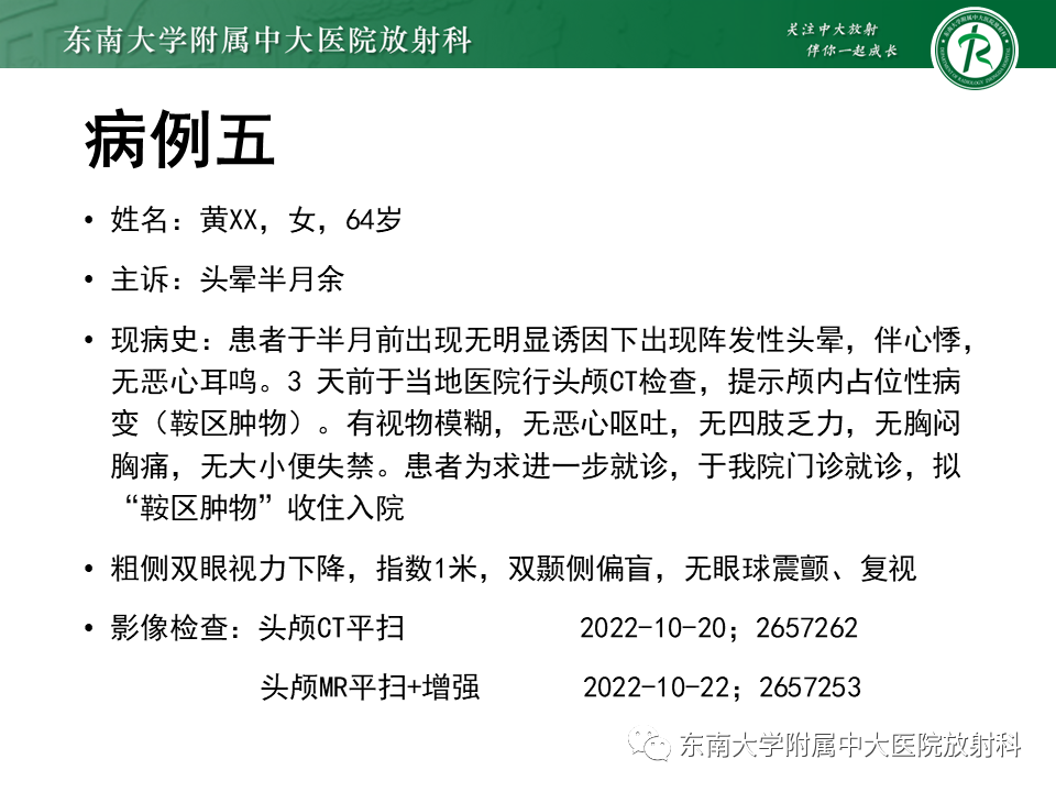 影像PPT - 【PPT】垂体细胞瘤-44