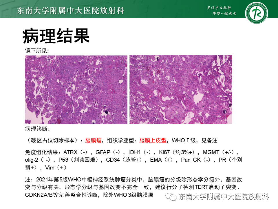 影像PPT - 【PPT】垂体细胞瘤-46