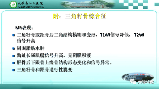 影像PPT - 【PPT】踝关节撞击综合征影像学-35