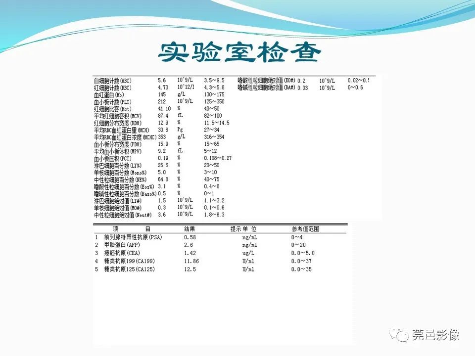 影像PPT - 【PPT】一例输尿管囊肿病例分享-4