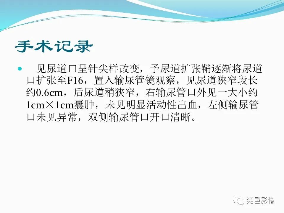 影像PPT - 【PPT】一例输尿管囊肿病例分享-13