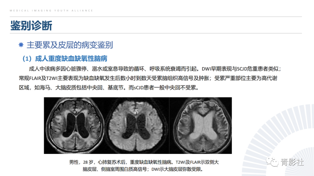 影像PPT - 【PPT】克雅氏病（Creutzfeldt-Jakob Disease）的影像诊断思路-16