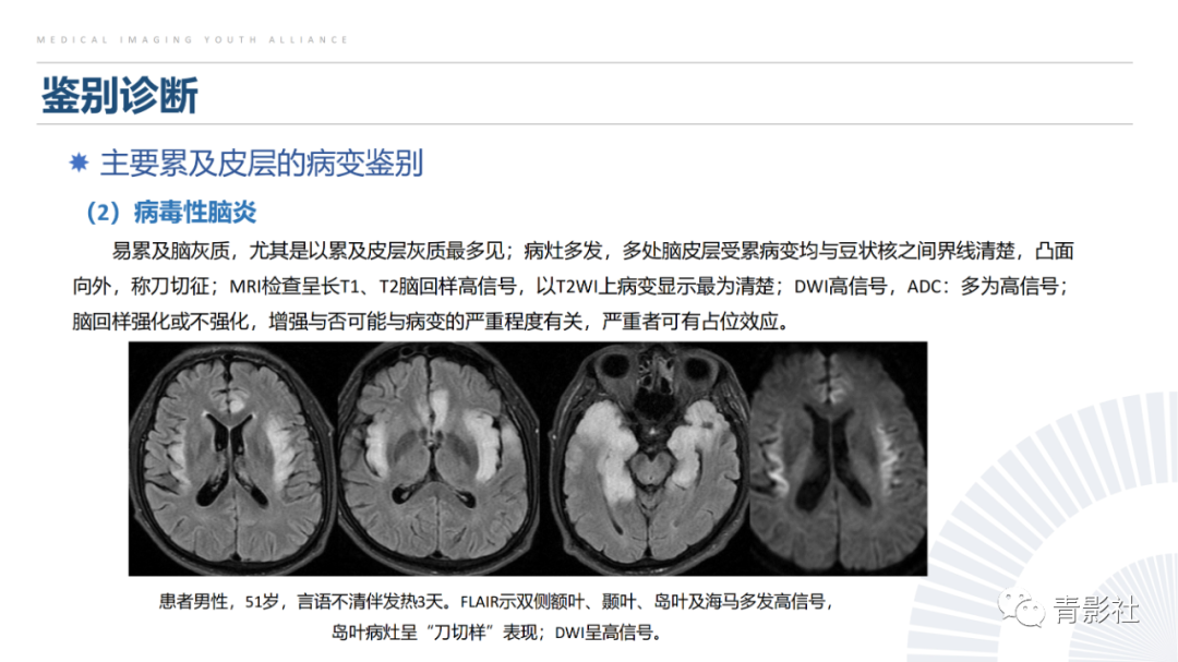 影像PPT - 【PPT】克雅氏病（Creutzfeldt-Jakob Disease）的影像诊断思路-17