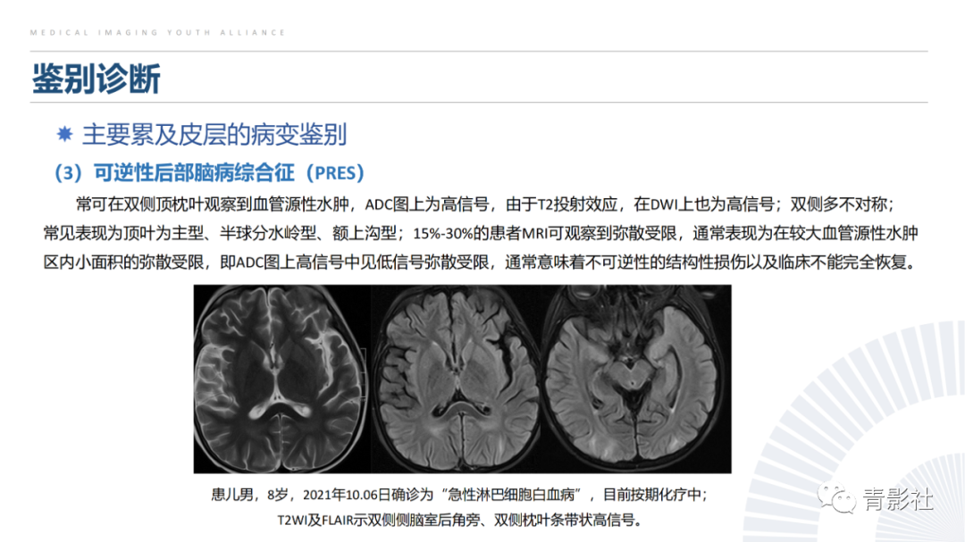 影像PPT - 【PPT】克雅氏病（Creutzfeldt-Jakob Disease）的影像诊断思路-18