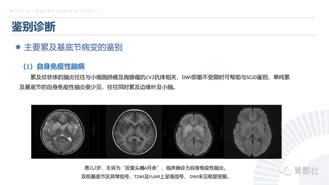 影像PPT - 【PPT】克雅氏病（Creutzfeldt-Jakob Disease）的影像诊断思路-21