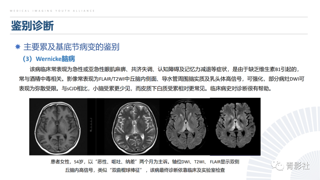 影像PPT - 【PPT】克雅氏病（Creutzfeldt-Jakob Disease）的影像诊断思路-23