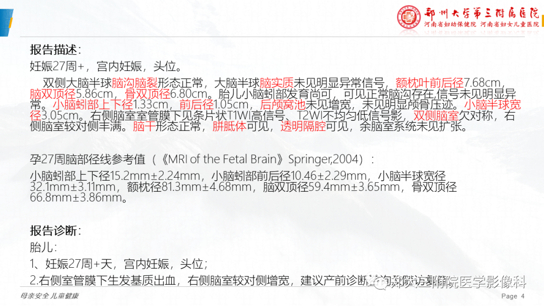 影像PPT - 【PPT】胎儿MRI颅脑径线测量标准-4