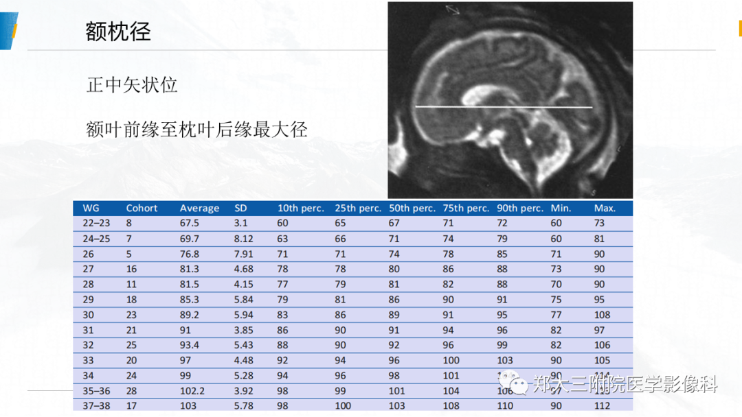 影像PPT - 【PPT】胎儿MRI颅脑径线测量标准-8