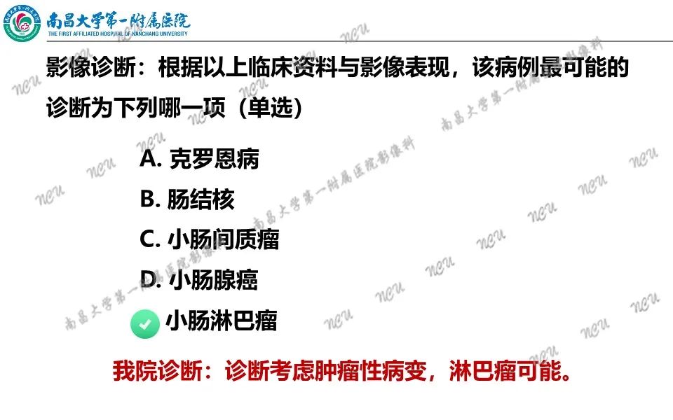 影像PPT - 【PPT】原发小肠淋巴瘤-6