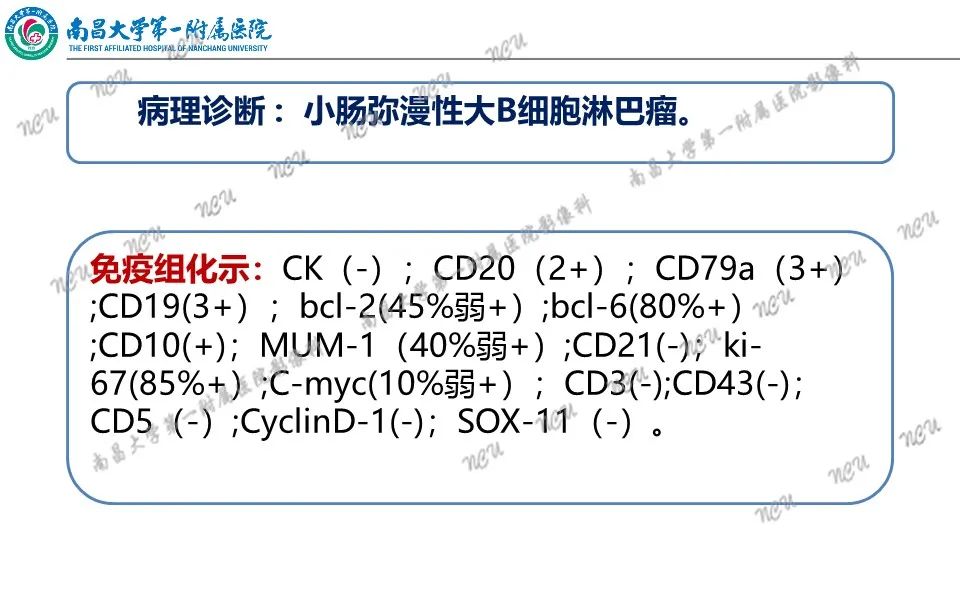 影像PPT - 【PPT】原发小肠淋巴瘤-7