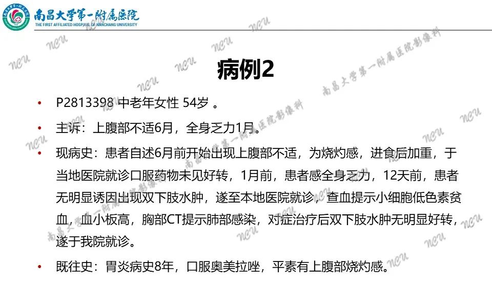 影像PPT - 【PPT】原发小肠淋巴瘤-8