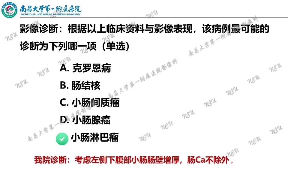 影像PPT - 【PPT】原发小肠淋巴瘤-11