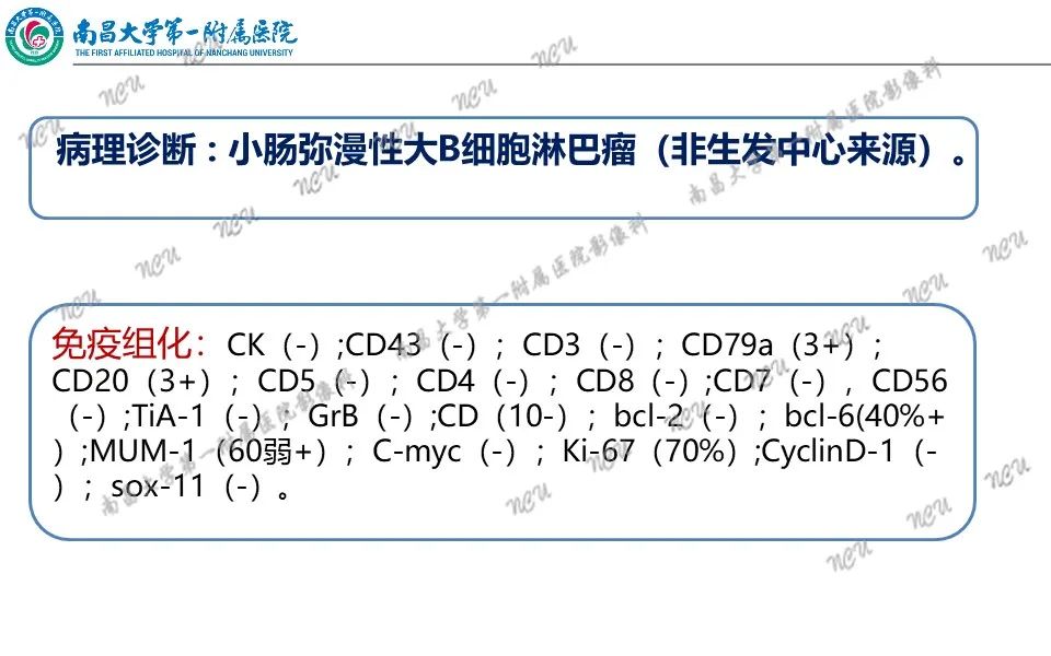 影像PPT - 【PPT】原发小肠淋巴瘤-12