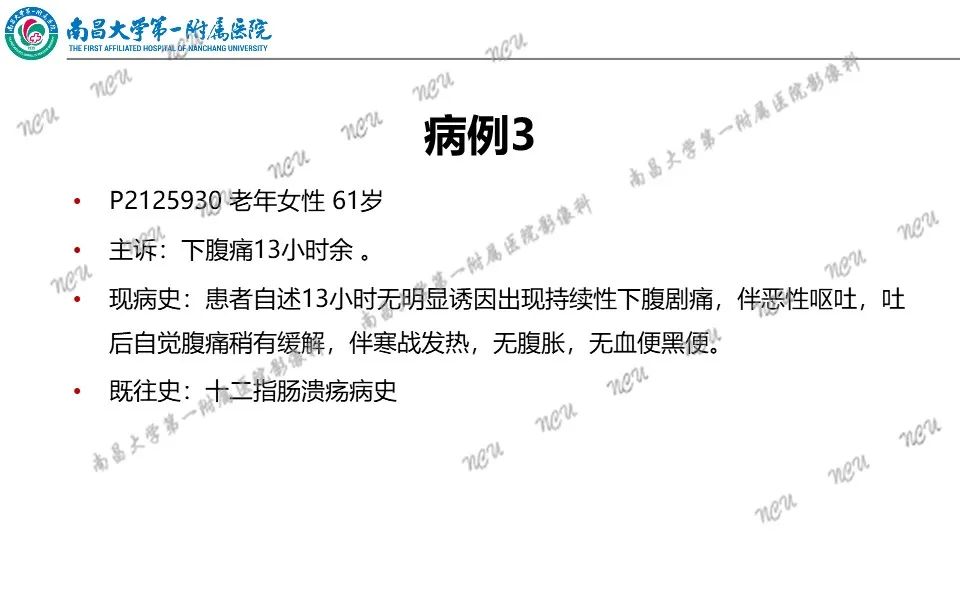 影像PPT - 【PPT】原发小肠淋巴瘤-13