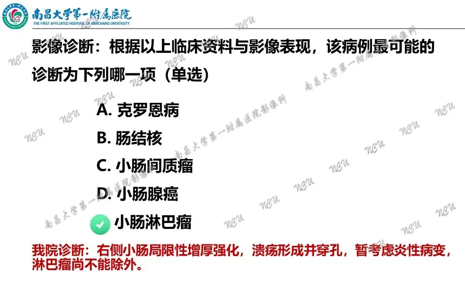 影像PPT - 【PPT】原发小肠淋巴瘤-16