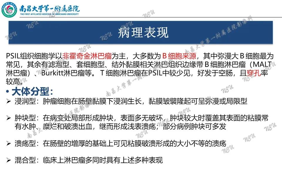 影像PPT - 【PPT】原发小肠淋巴瘤-21