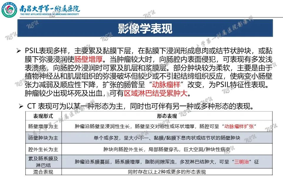 影像PPT - 【PPT】原发小肠淋巴瘤-23
