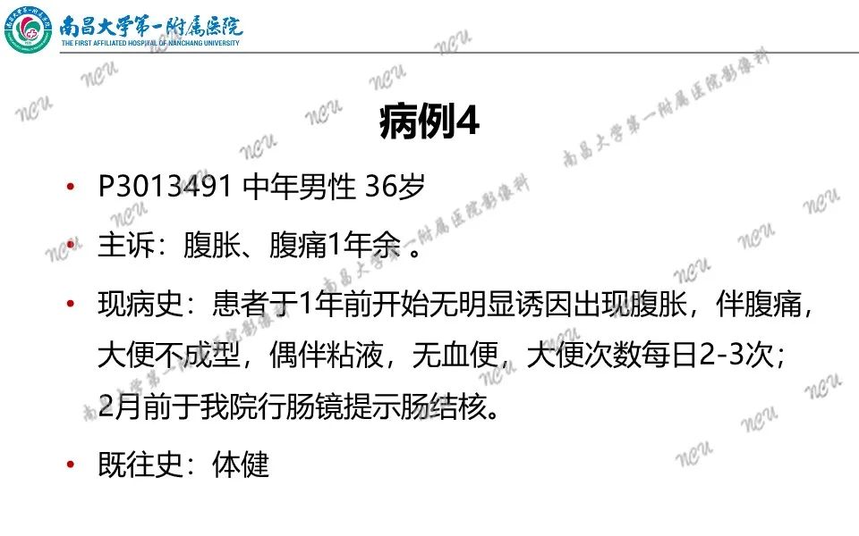 影像PPT - 【PPT】原发小肠淋巴瘤-31