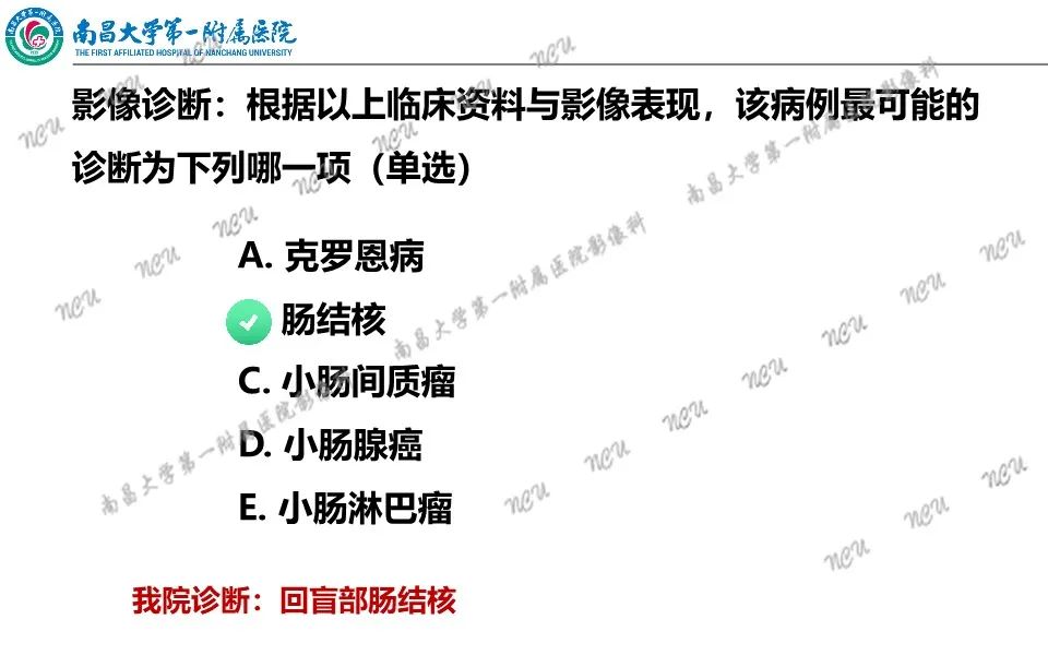 影像PPT - 【PPT】原发小肠淋巴瘤-35