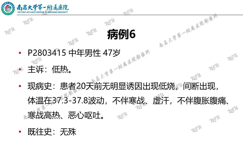 影像PPT - 【PPT】原发小肠淋巴瘤-37