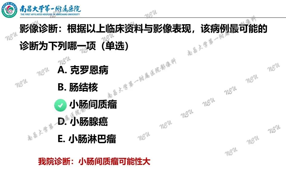 影像PPT - 【PPT】原发小肠淋巴瘤-41
