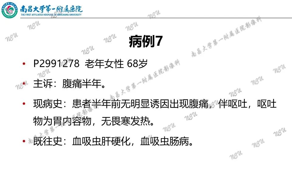 影像PPT - 【PPT】原发小肠淋巴瘤-43