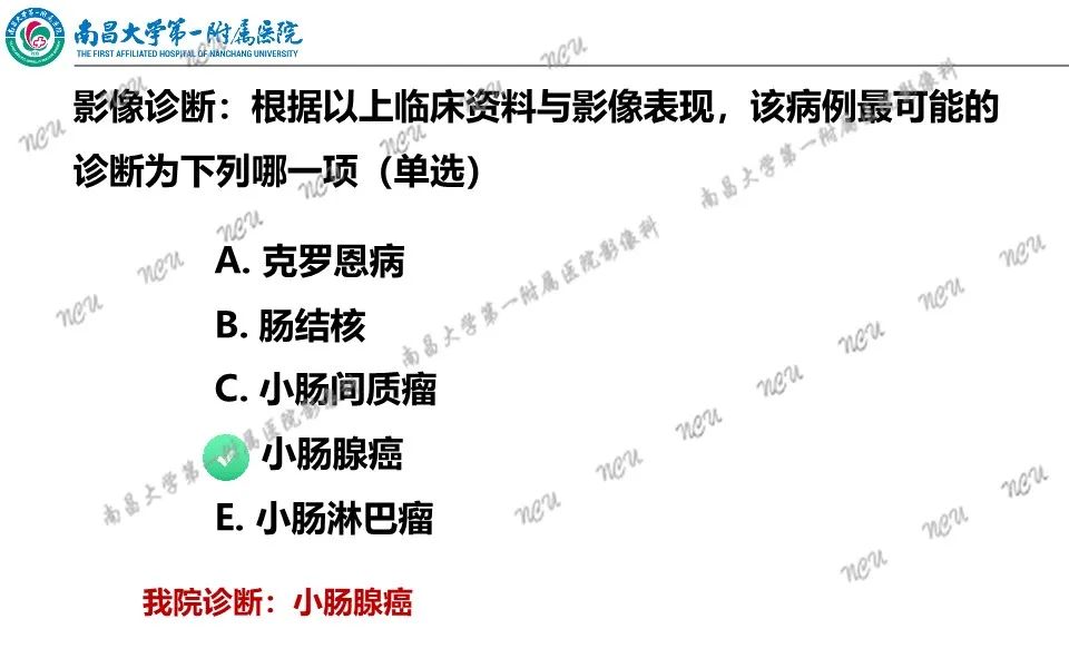 影像PPT - 【PPT】原发小肠淋巴瘤-46