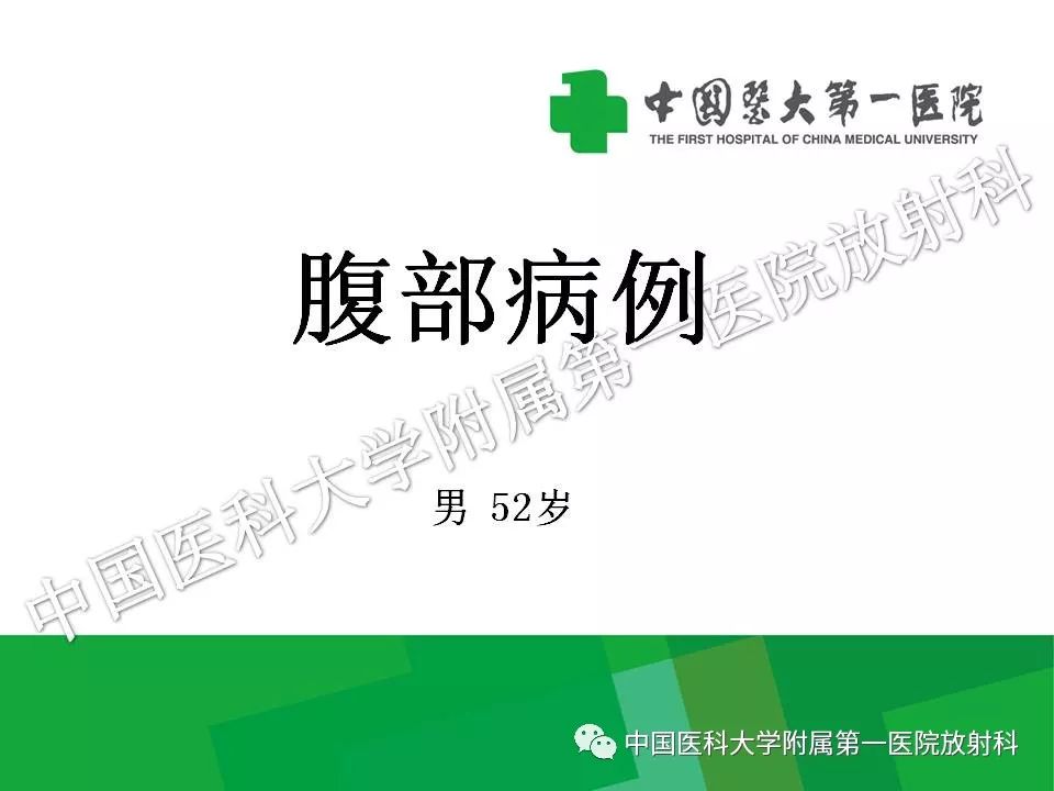 影像PPT - 【PPT】腹膜后孤立性纤维性肿瘤-1