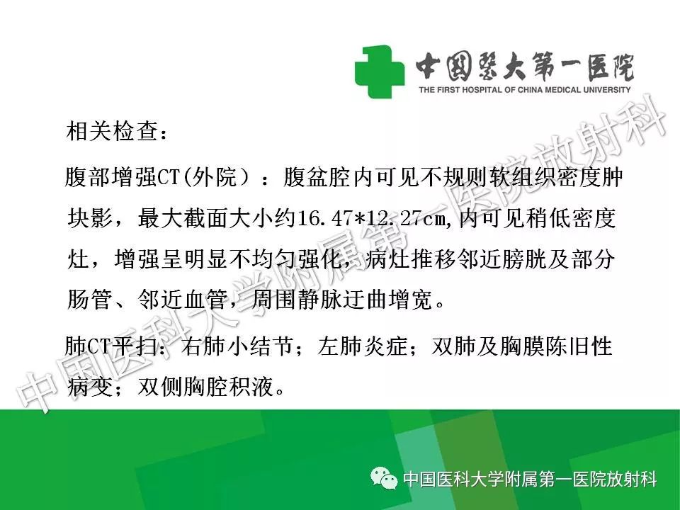 影像PPT - 【PPT】腹膜后孤立性纤维性肿瘤-4