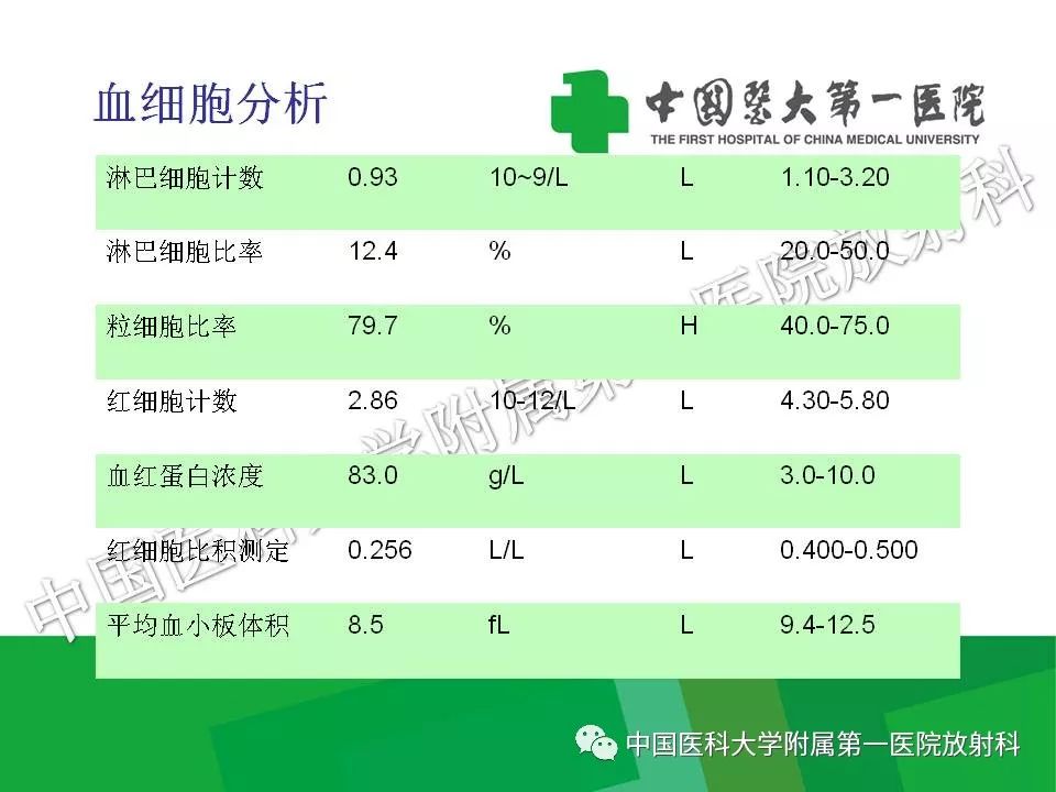 影像PPT - 【PPT】腹膜后孤立性纤维性肿瘤-5