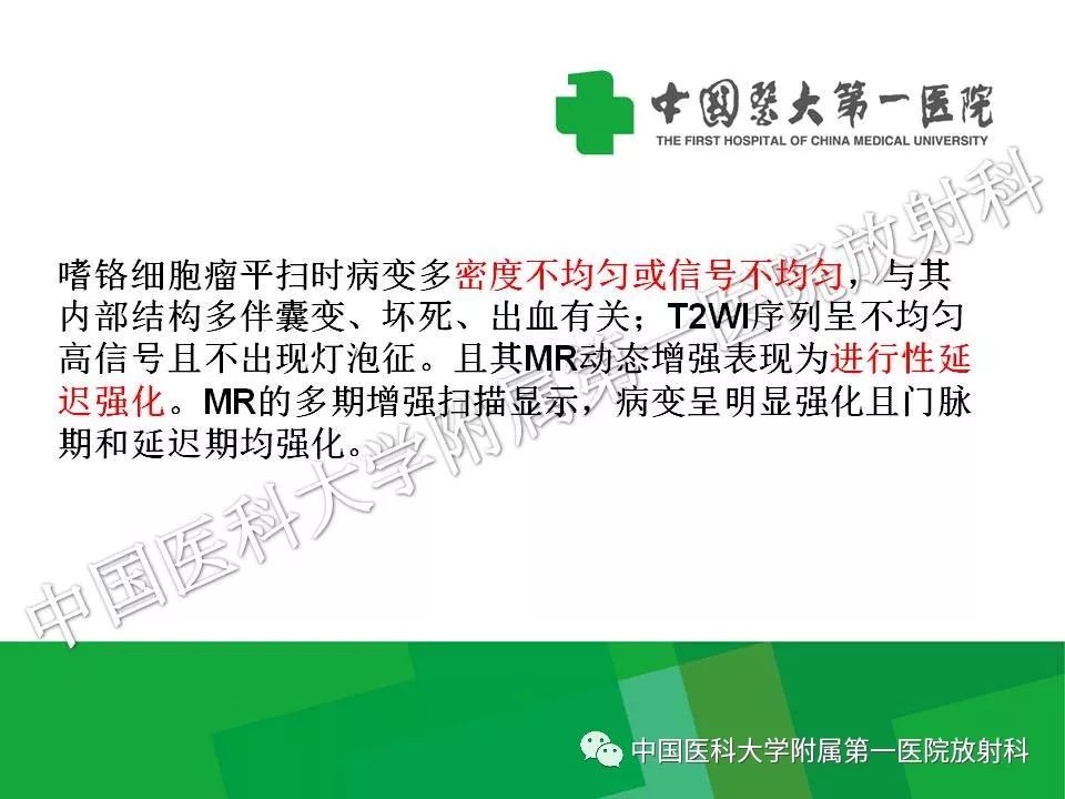 影像PPT - 【PPT】腹膜后孤立性纤维性肿瘤-20