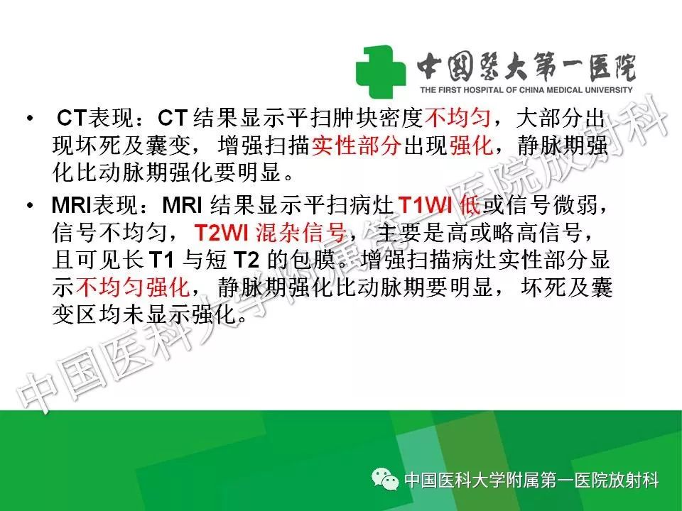 影像PPT - 【PPT】腹膜后孤立性纤维性肿瘤-29