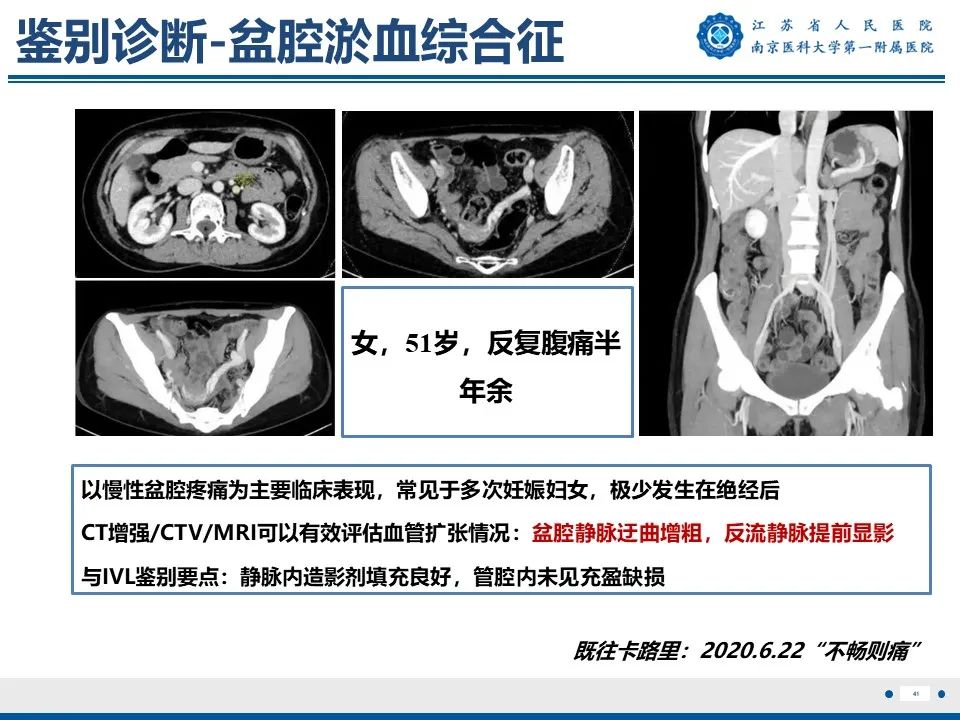 影像PPT - 【PPT】静脉内的“爬山虎”——静脉内平滑肌瘤病-42