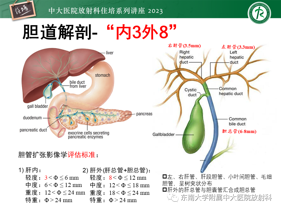 影像PPT - 【PPT】继发性肝内胆管局部扩张影像诊断-2
