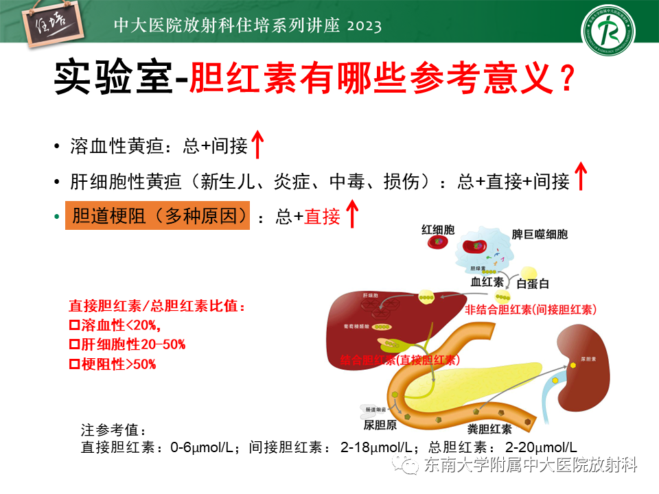 影像PPT - 【PPT】继发性肝内胆管局部扩张影像诊断-4