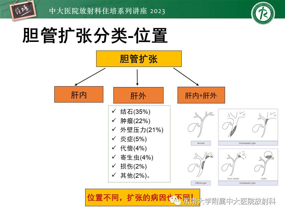 影像PPT - 【PPT】继发性肝内胆管局部扩张影像诊断-6