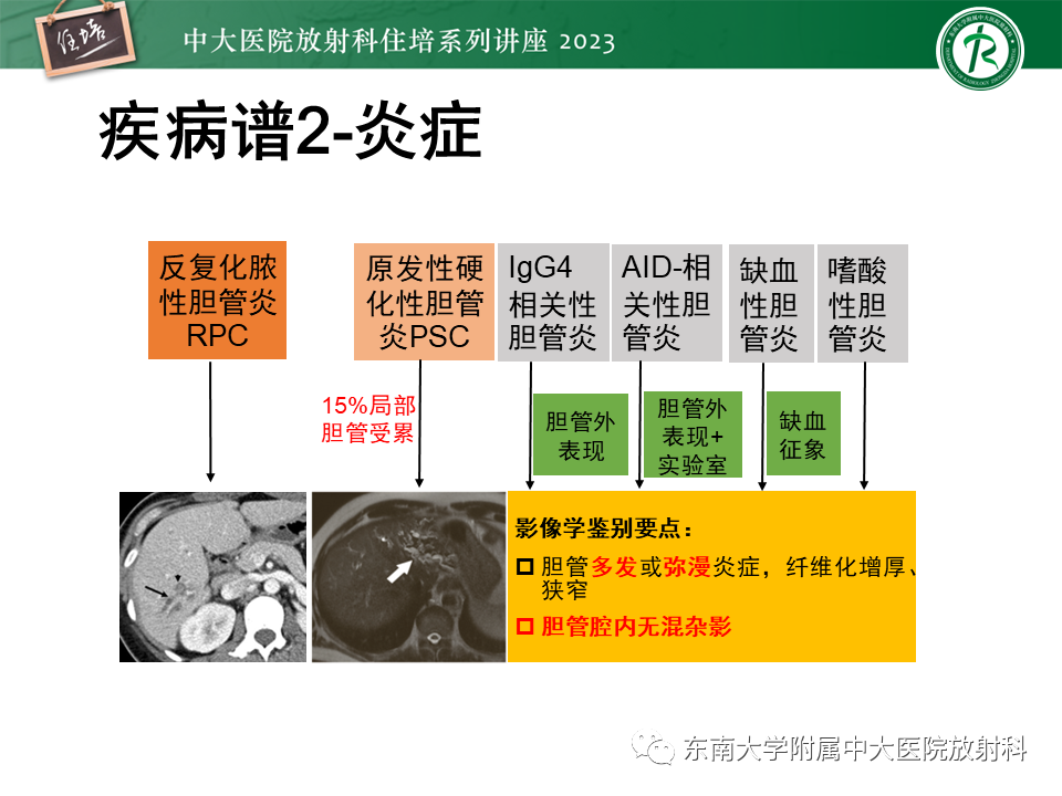 影像PPT - 【PPT】继发性肝内胆管局部扩张影像诊断-16