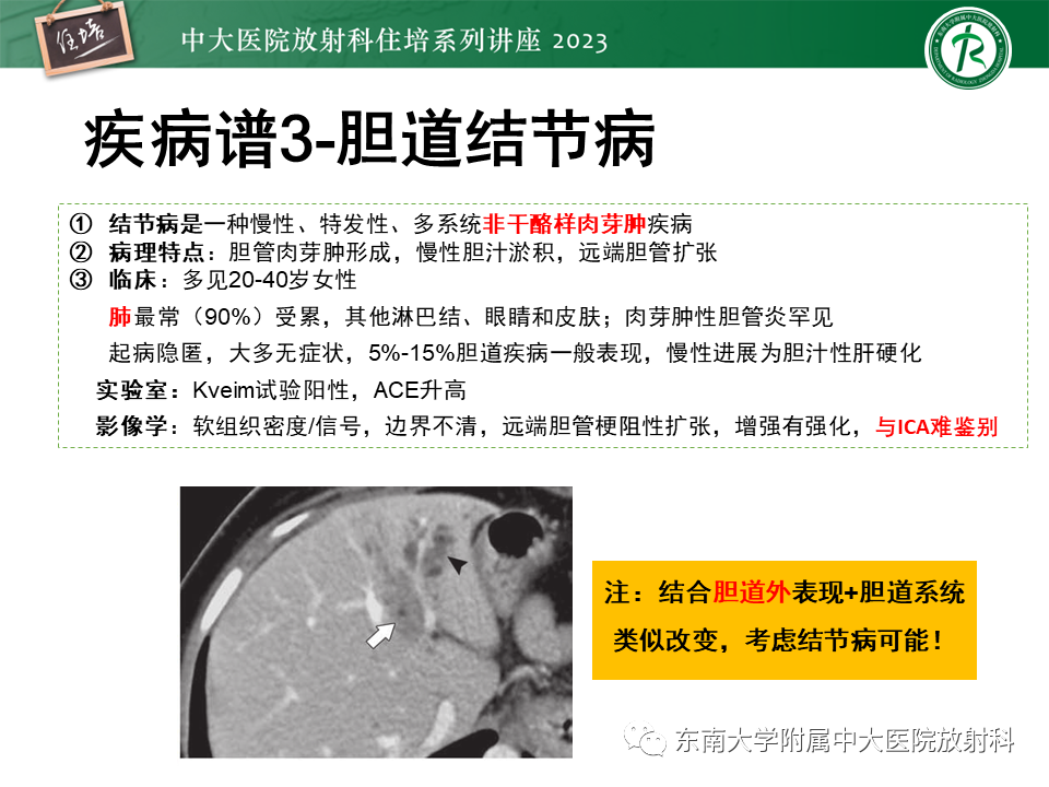 影像PPT - 【PPT】继发性肝内胆管局部扩张影像诊断-19