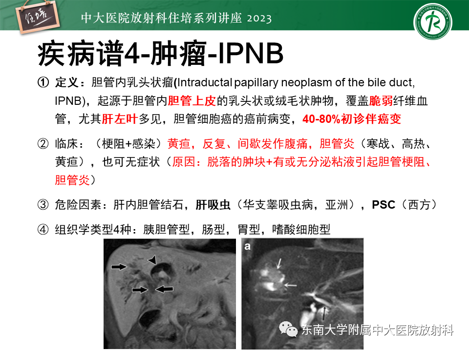 影像PPT - 【PPT】继发性肝内胆管局部扩张影像诊断-20