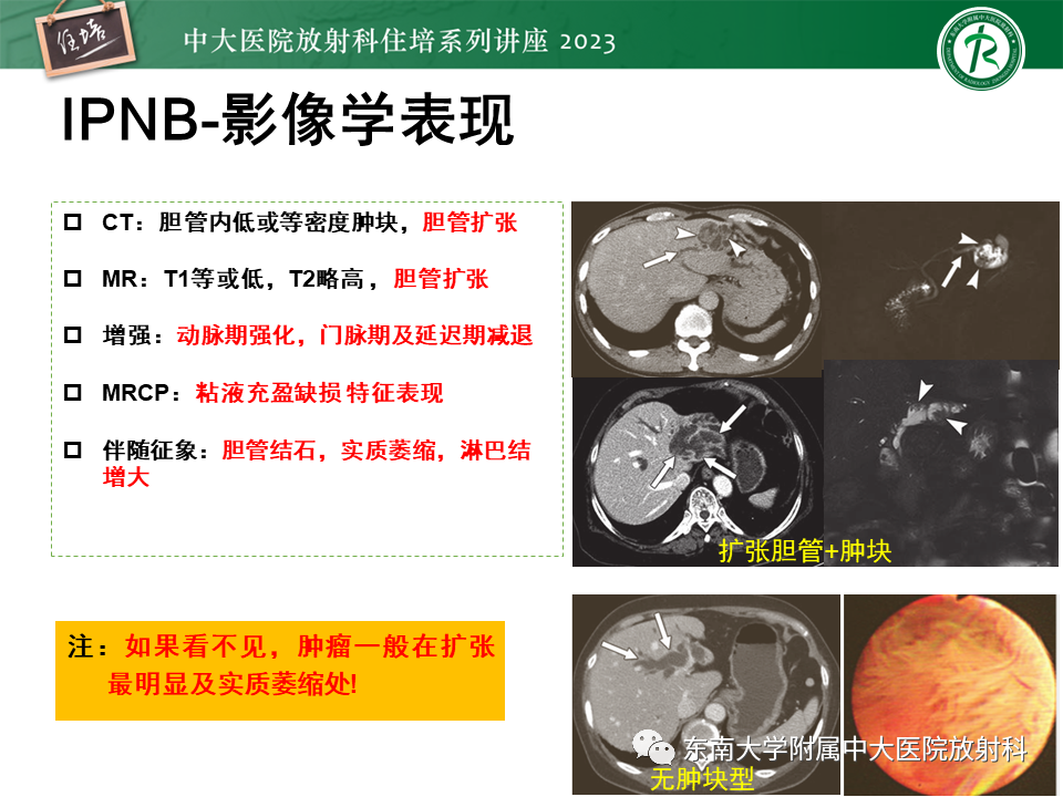 影像PPT - 【PPT】继发性肝内胆管局部扩张影像诊断-23