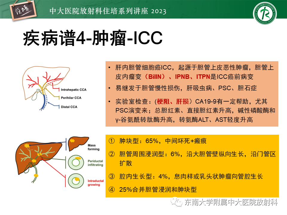 影像PPT - 【PPT】继发性肝内胆管局部扩张影像诊断-29