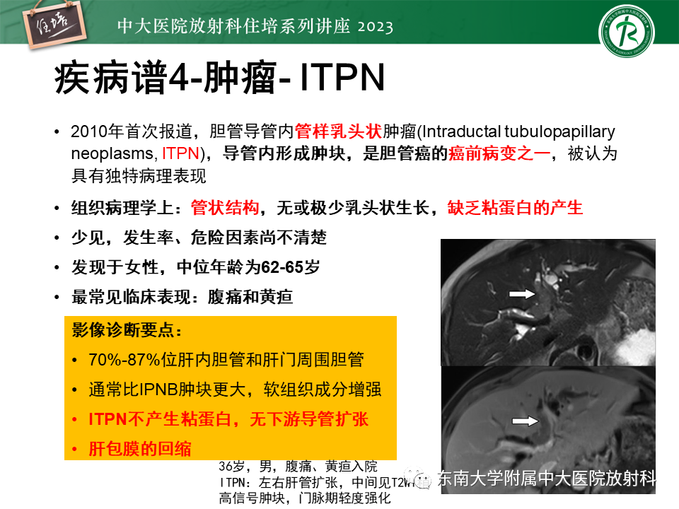 影像PPT - 【PPT】继发性肝内胆管局部扩张影像诊断-35